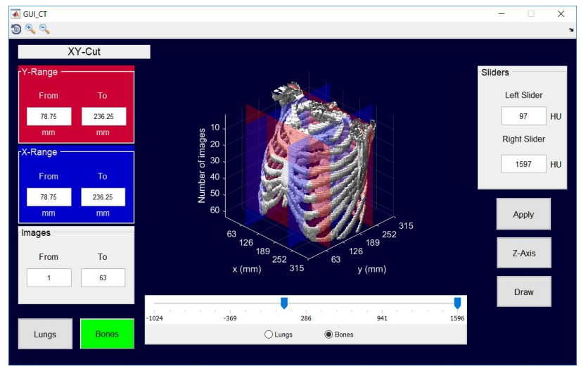 Application showing a 3D model of a rib cage