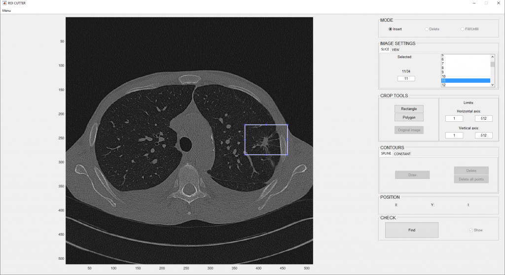 Screenshot of an application for CT image analysis